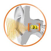 extended-wear digram of a device inside of an ear for an extended time