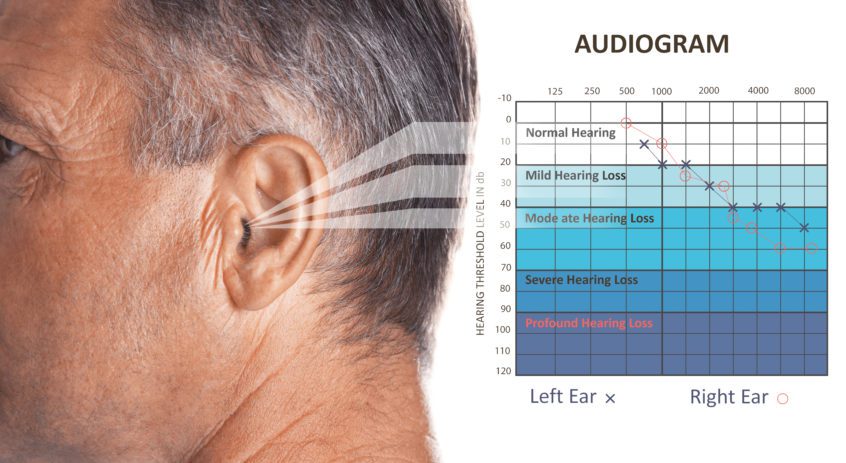 hearing tests can determine whether you have hearing loss