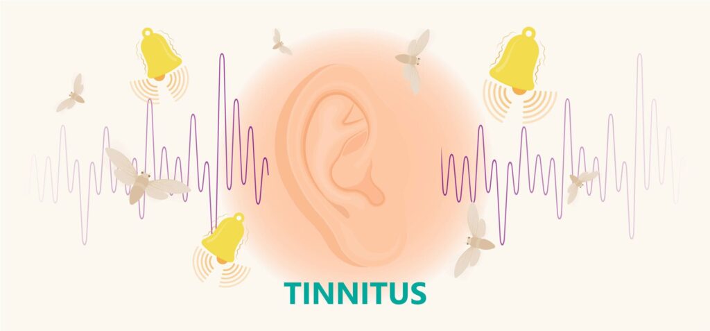 What Is Tinnitus and How Do I Know if I Have It?