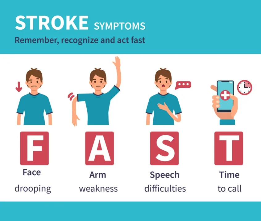 recognize signs of stroke, Associated Audiologists Kansas City